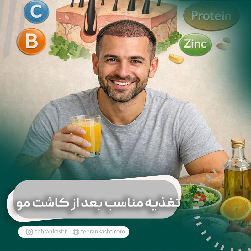 تغذیه مناسب بعد از کاشت مو