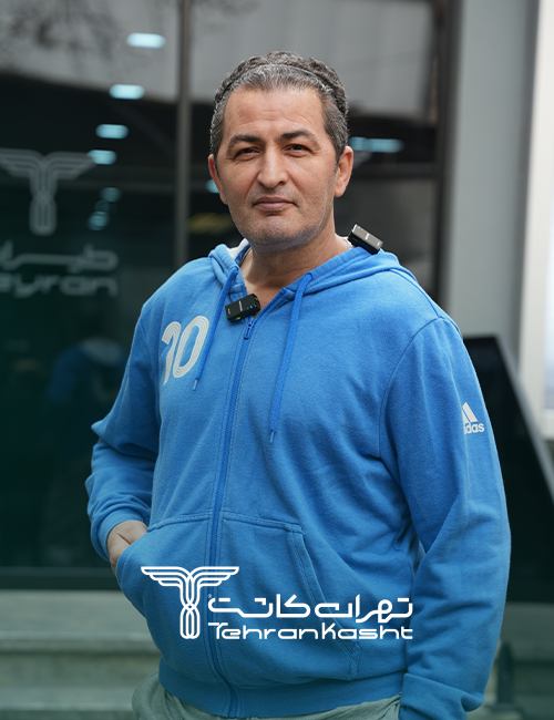 نمونه کار کاشت مو