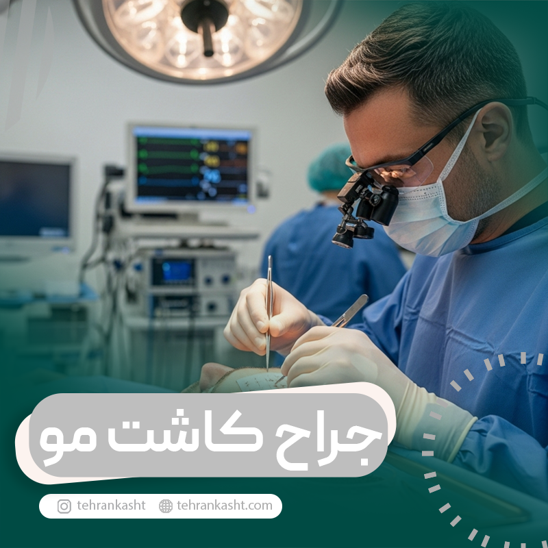 انتخاب جراح کاشت مو
