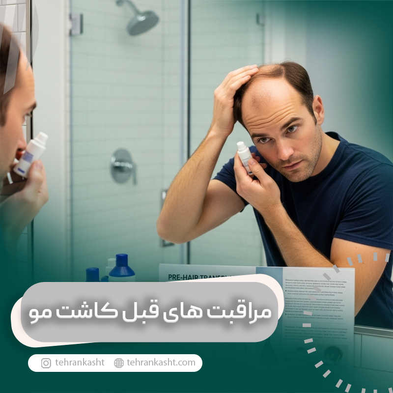 مراقبت های قبل از کاشت مو