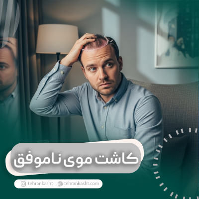 علائم کاشت موی ناموفق