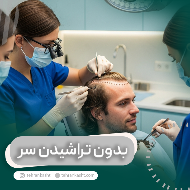 کاشت مو بدون تراشیدن سر