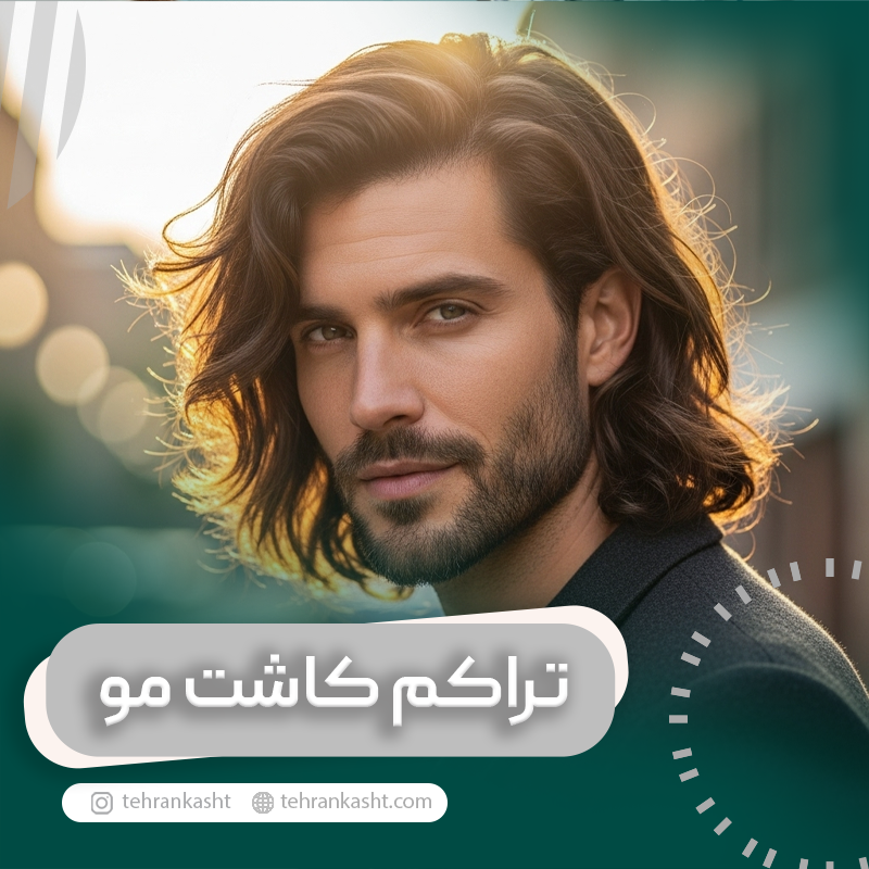 بالاترین تراکم کاشت مو چقدر است؟