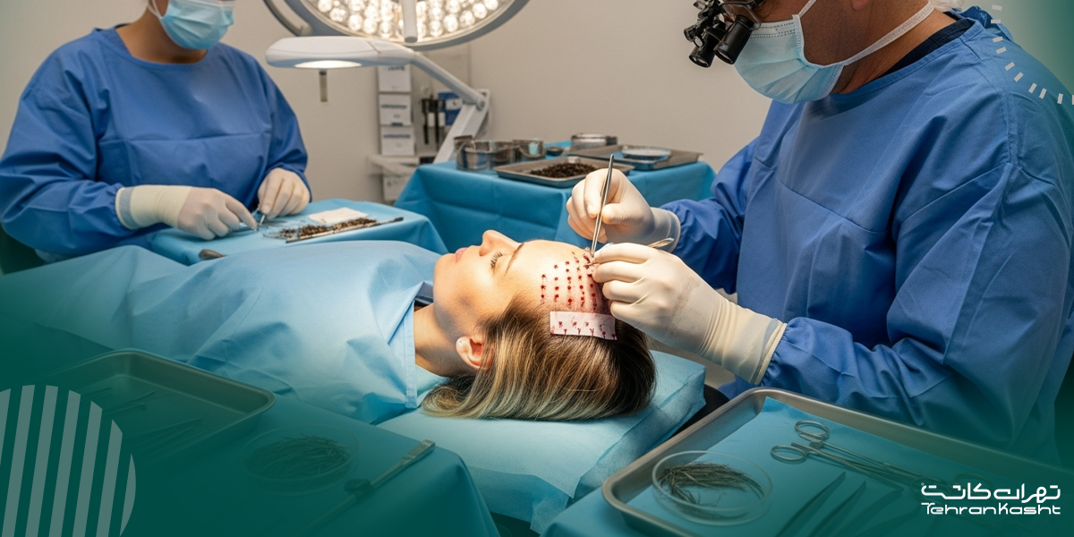 چرا زنان دچار ریزش مو می‌شوند؟ بررسی علل رایج