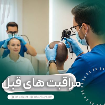 مراقبت های قبل از کاشت مو