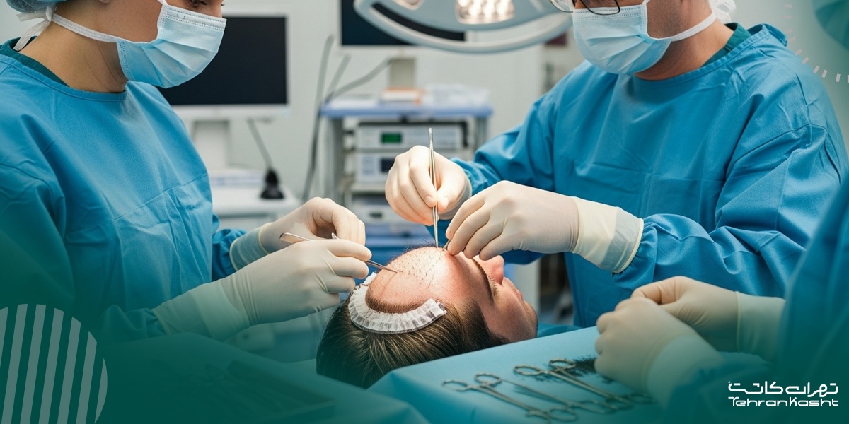 نقش مشاوره تخصصی در موفقیت کاشت مو