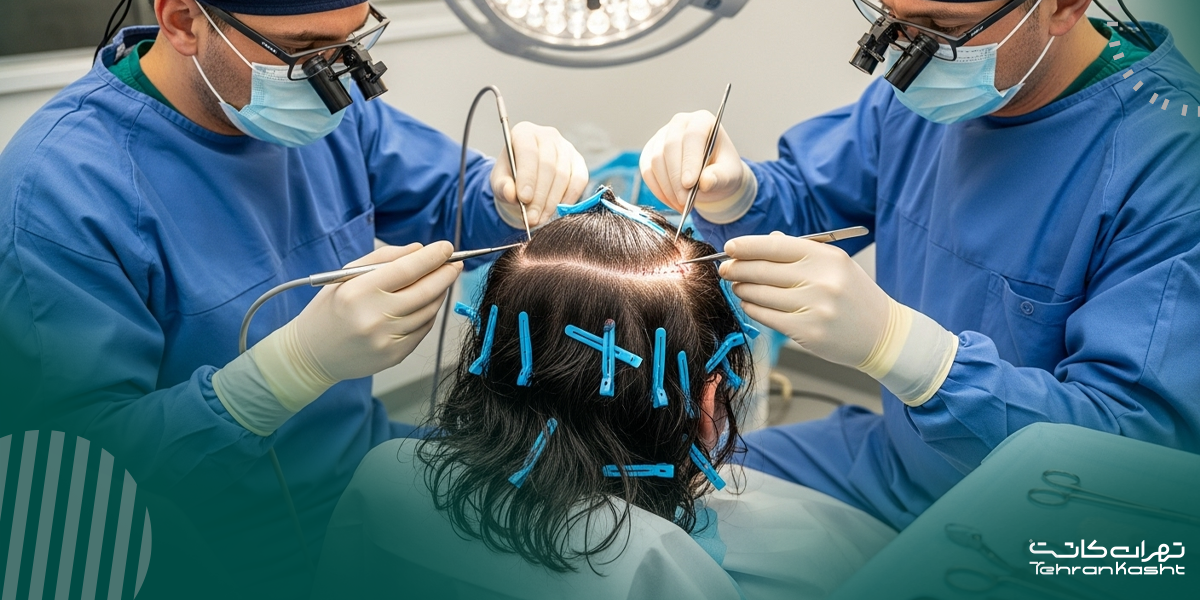 کاشت مو بدون تراشیدن سر: آیا امکانپذیر است؟