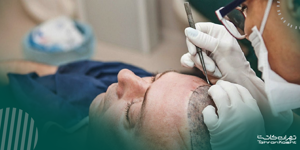 مراحل گام‌به‌گام کاشت مو به روش DHI: از مشاوره تا رشد نهایی