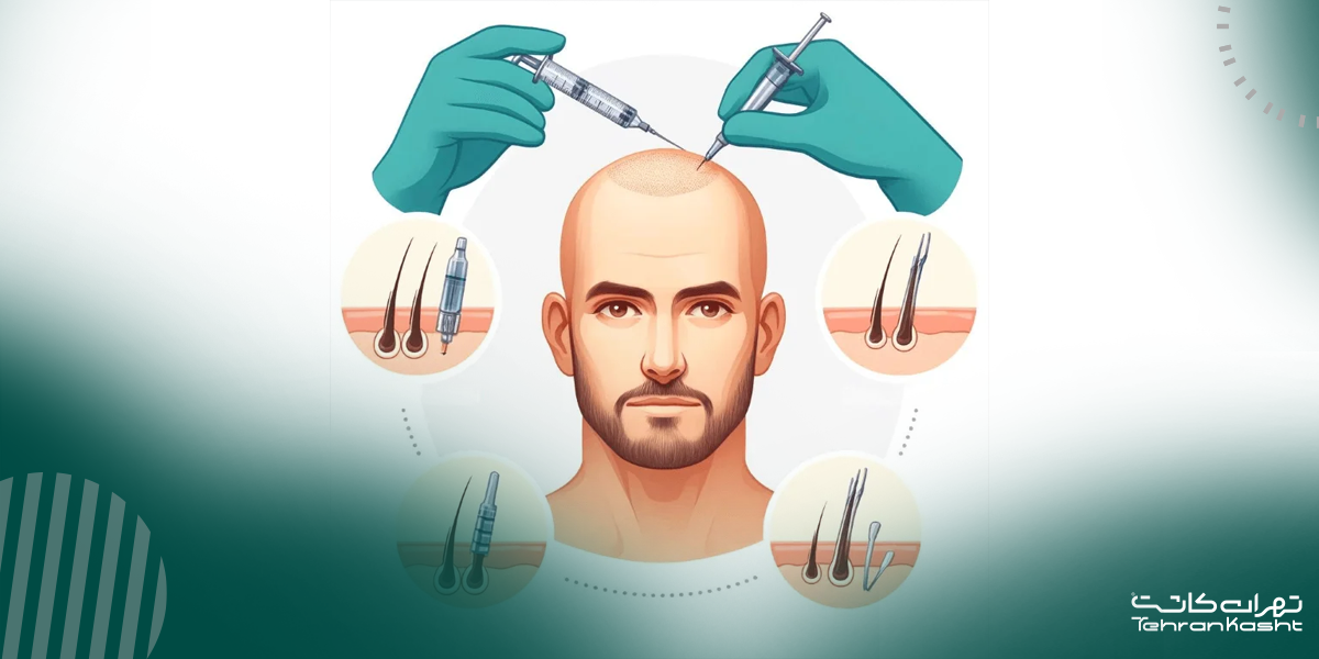 مراحل گام‌به‌گام کاشت مو به روش DHI: از مشاوره تا رشد نهایی