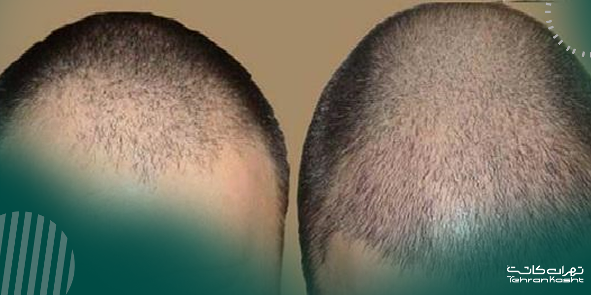 مقایسه روش FUT با سایر روشها