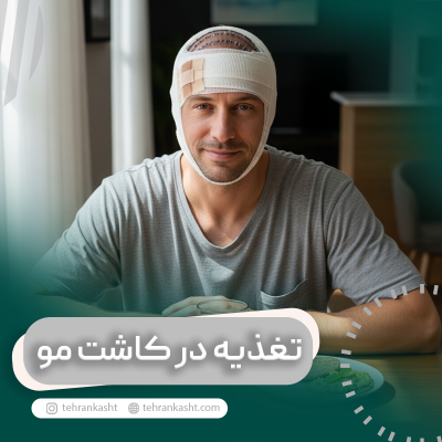 تغذیه در کاشت مو