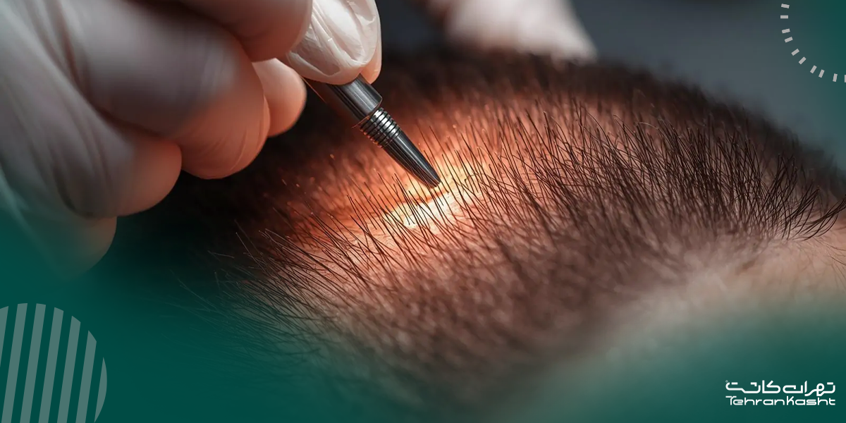 آمادهسازی و کاشت گرافتها در مناطق گیرنده