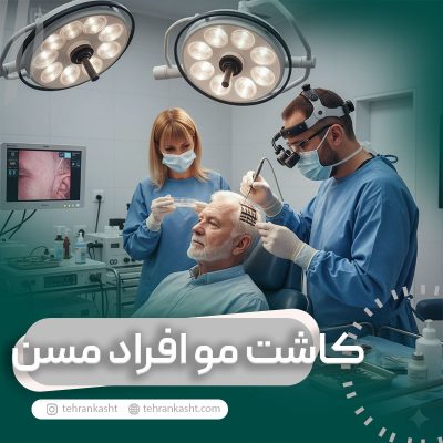 کاشت مو برای افراد مسن