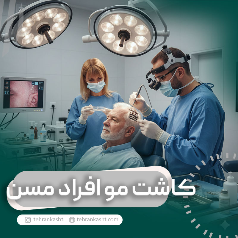 کاشت مو برای افراد مسن