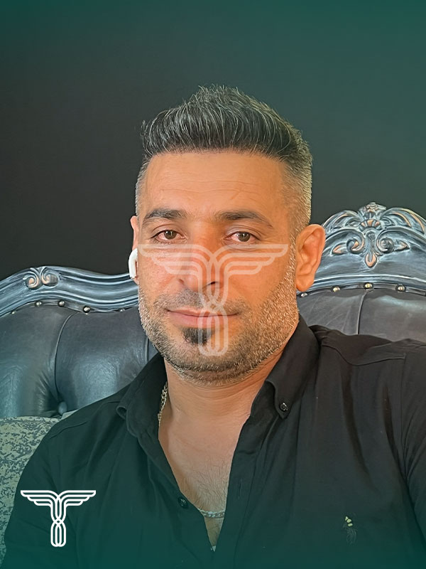 بعد کاشت مو