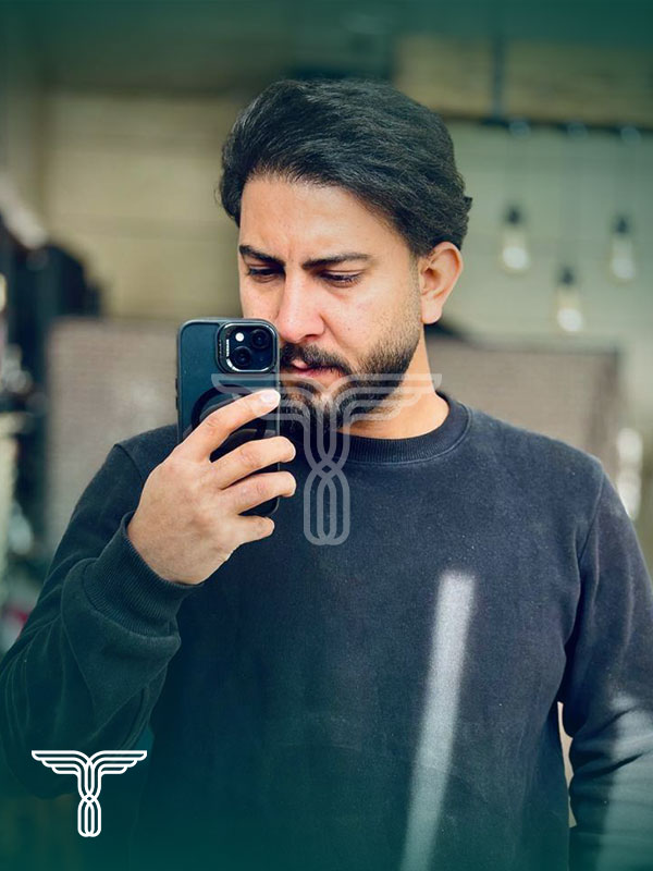 بعد کاشت مو