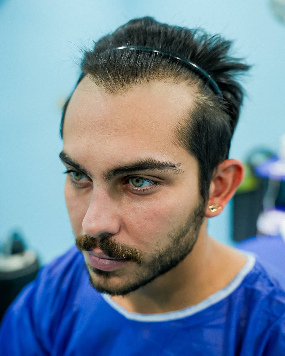 ارسلان قاسمی قبل کاشت