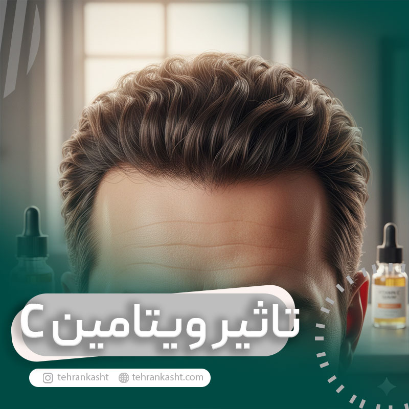 تاثیر ویتامین c در کاشت مو