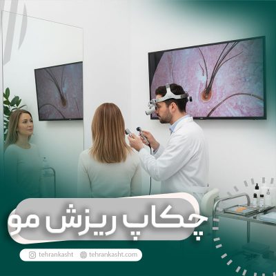 چکاپ برای ریزش مو