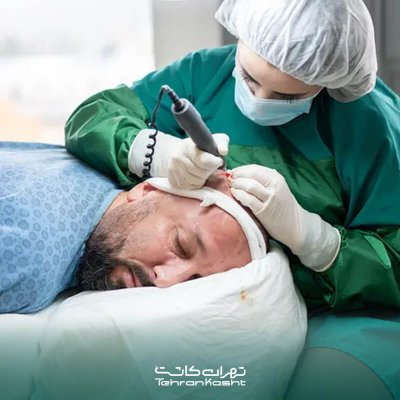 چگونه بهترین جراح کاشت مو را انتخاب کنیم